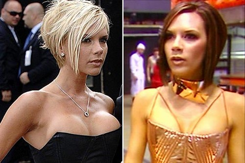 Victoria Beckham Breast Implants