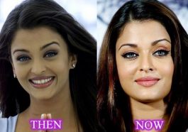 10 Bollywood Actresses Who Went Through Plastic Surgery 3