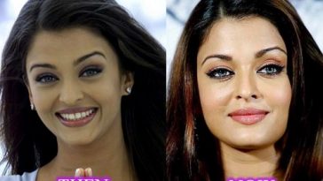 10 Bollywood Actresses Who Went Through Plastic Surgery 3