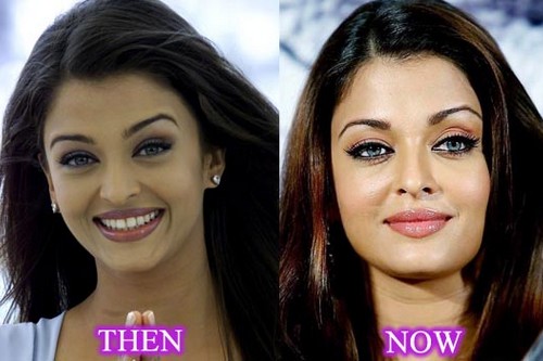 Bollywood Actresses Who Went Through Plastic Surgery