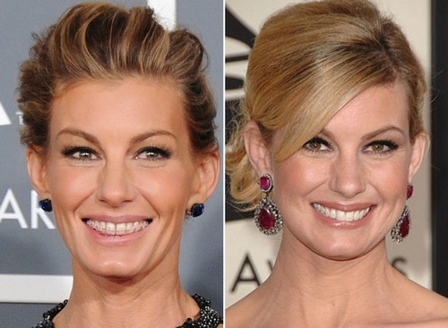 Faith Hill Famous Actresses with Braces 