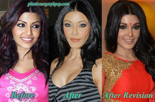 Bollywood Actresses Who Went Through Plastic Surgery