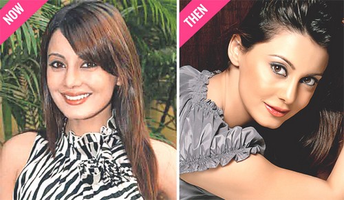 Bollywood Actresses Who Went Through Plastic Surgery