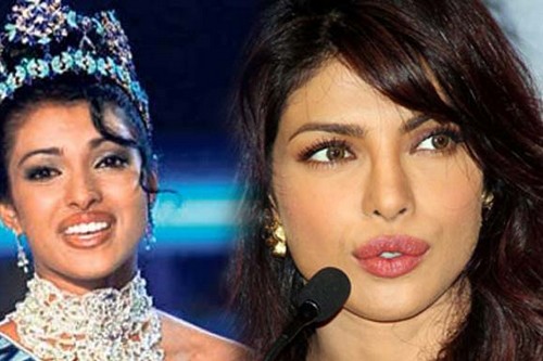 Bollywood Actresses Who Went Through Plastic Surgery