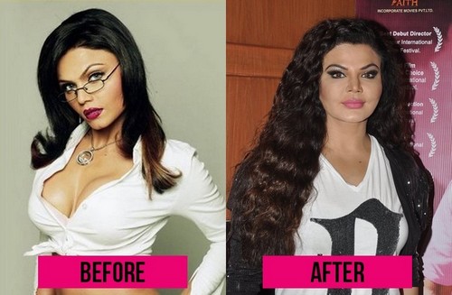 Bollywood Actresses Who Went Through Plastic Surgery
