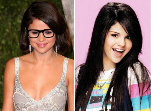 Selena Gomez Famous Actresses with Braces 