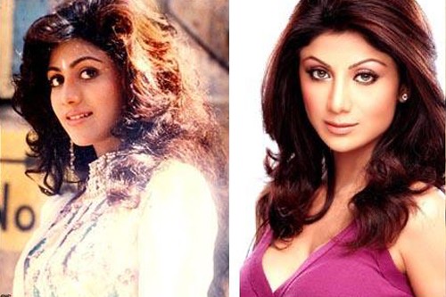 Bollywood Actresses Who Went Through Plastic Surgery